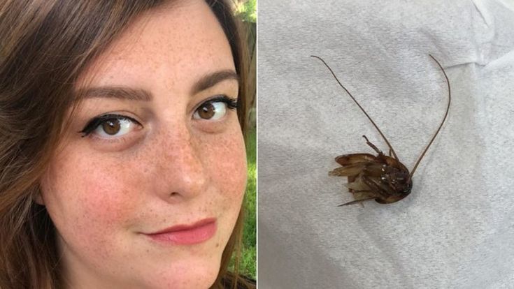 woman_smiling_despite_hearing_ that_was_interrupted_by_a_cockroach_in_her_ear