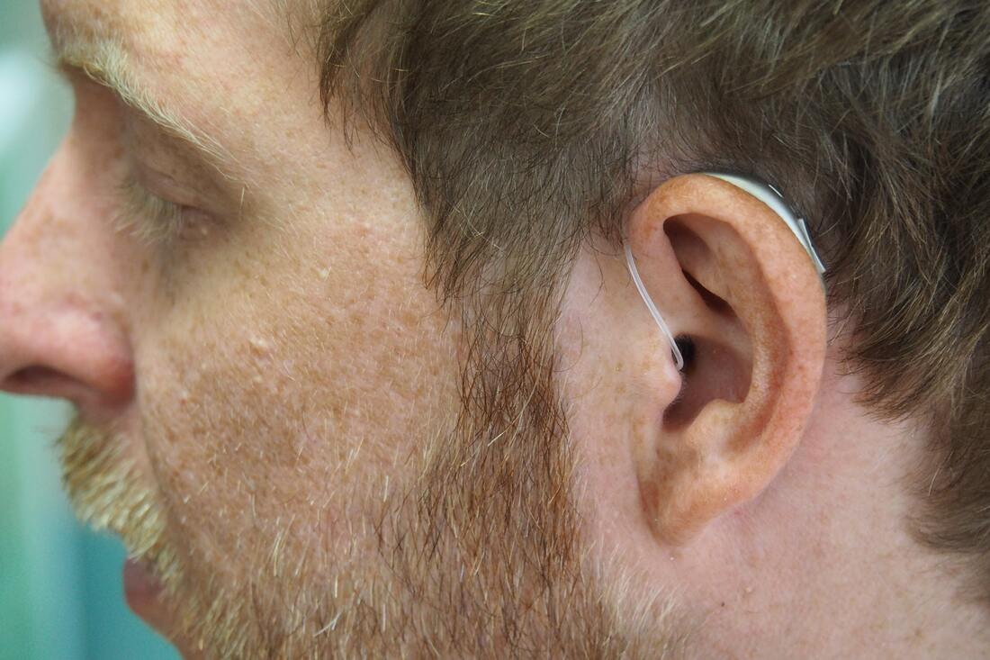 A man with a blonde-brown beard and freckles has a hearing aid securely fit into his ear.